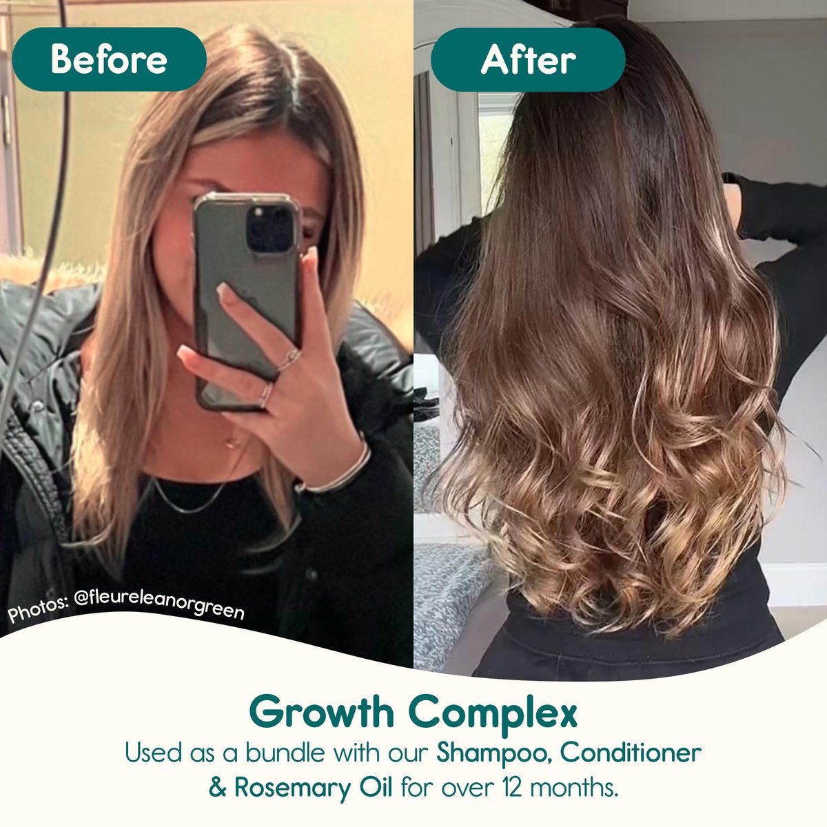 Nature Spell Haarwachstum Complex Conditioner - Sulfat- & Parabenfrei, mit Hyaluronsäure & Vitamin B5, 300 ml