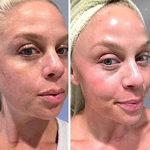 Retinol Gel 0,1% Vitamin A – Anti-Aging Formel gegen Falten, Altersflecken & Narben 20g