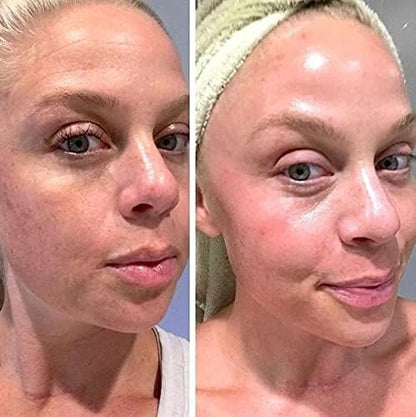 Retinol Gel 0,1% Vitamin A – Anti-Aging Formel gegen Falten, Altersflecken & Narben 20g