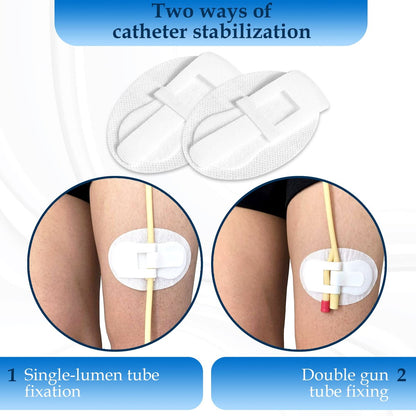 Foley-Katheter-Befestigungsvorrichtung, Urinbeutelhalter für das Bein, 4er-Pack