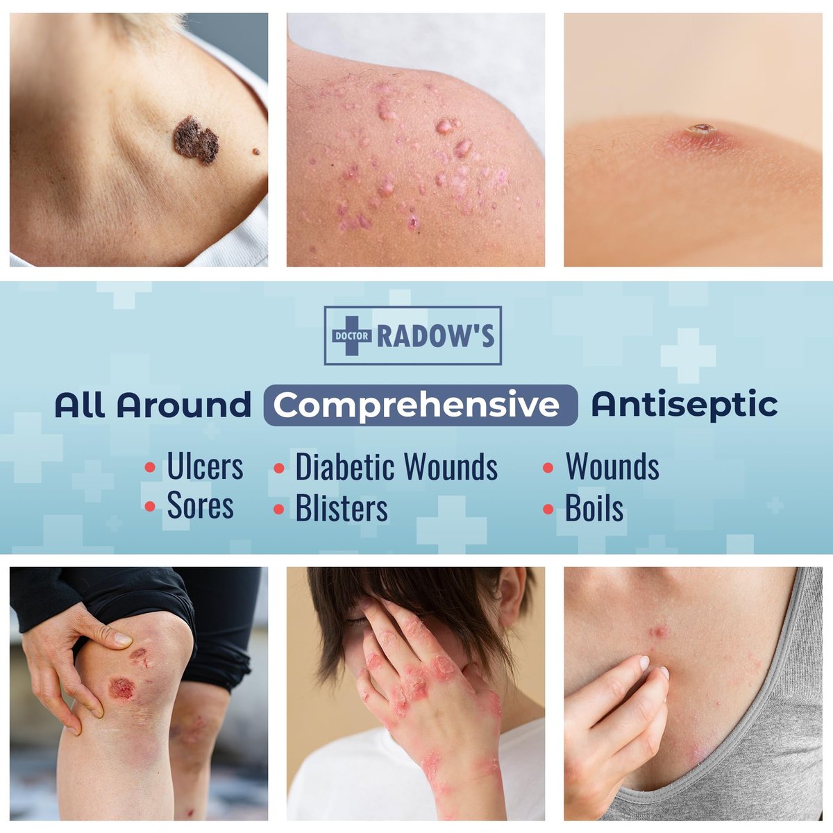 Doctor Radow’s Povidon-Iod Antiseptische Salbe – 10% Povidon-Iod, ohne Antibiotika, für Wunden, Verbrennungen, Schnitte & mehr, fördert schnellere Heilung, für den Haus- und Medizingebrauch, 28,35 g (1 Unze)