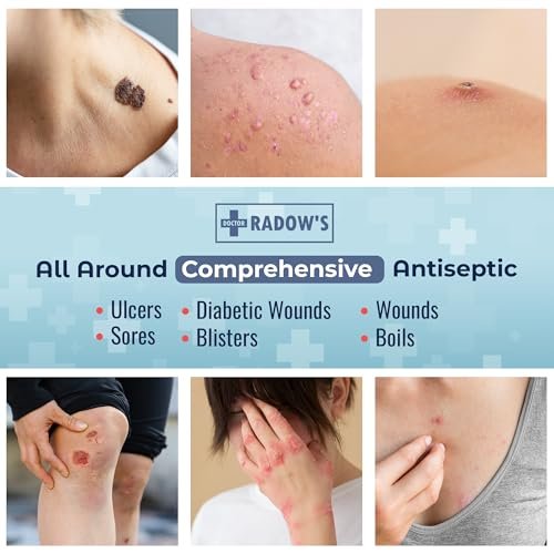 Doctor Radow’s Povidon-Iod Antiseptische Salbe – 10% Povidon-Iod, ohne Antibiotika, für Wunden, Verbrennungen, Schnitte & mehr, fördert schnellere Heilung, für den Haus- und Medizingebrauch, 28,35 g (1 Unze)