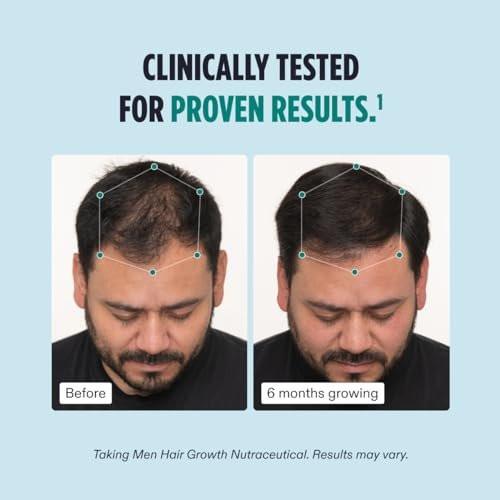Nutrafol Männer Haarausfall Ergänzung und Kollagenpeptide Pulver – Ärztlich formuliert für sichtbar dichteres, stärkeres Haar – Dermatologen empfohlen – 1 Monatsvorrat, 340 g Flasche