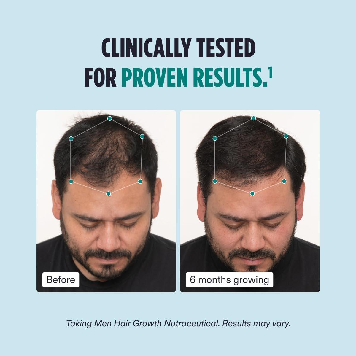 Nutrafol Männer Haarausfall Ergänzung und Kollagenpeptide Pulver – Ärztlich formuliert für sichtbar dichteres, stärkeres Haar – Dermatologen empfohlen – 1 Monatsvorrat, 340 g Flasche