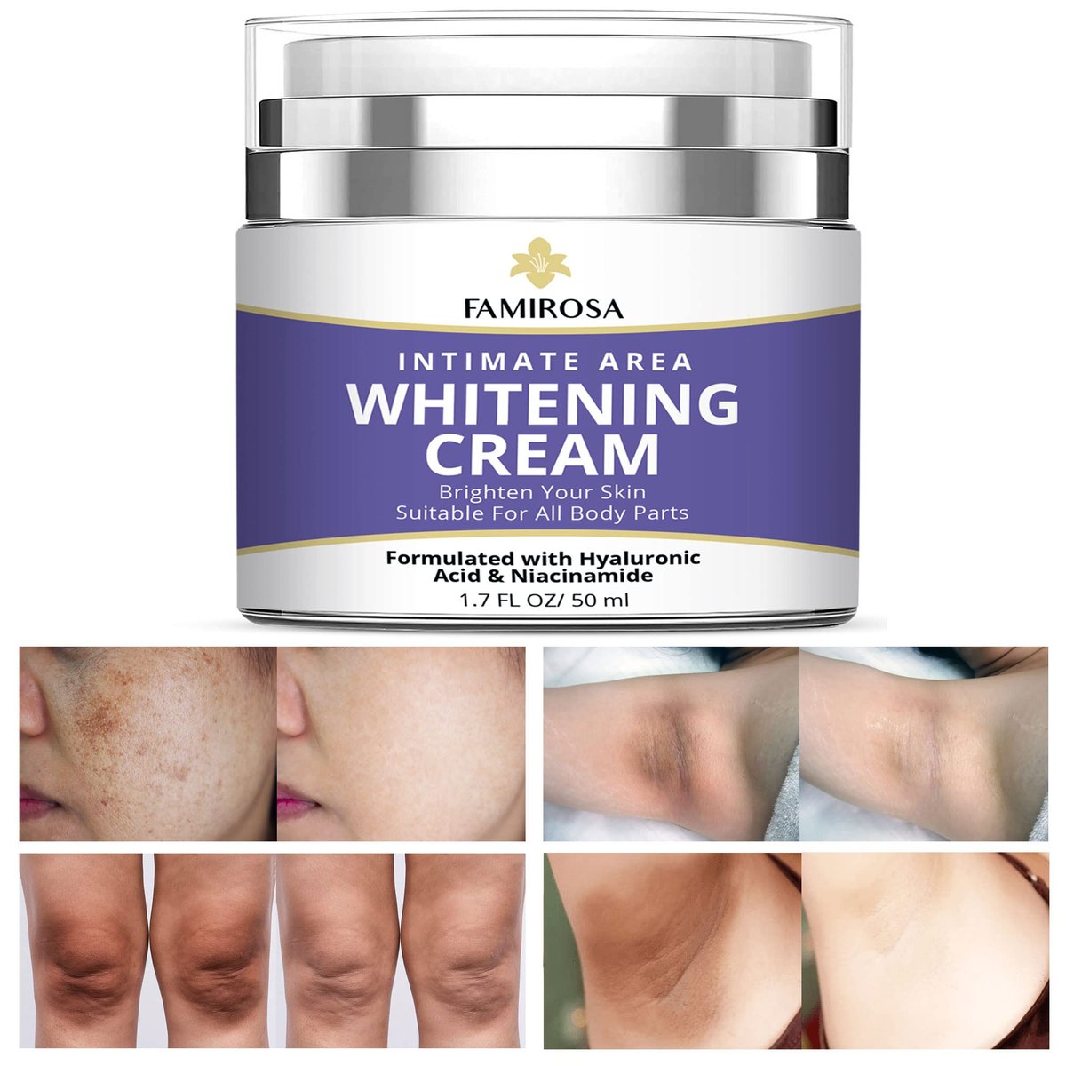 FAMIROSA Intimbereich Dunkle Flecken Korrektur: Creme für Achseln, Knie, Ellbogen, Innenseite der Oberschenkel, Intimbereich - 50 ml
