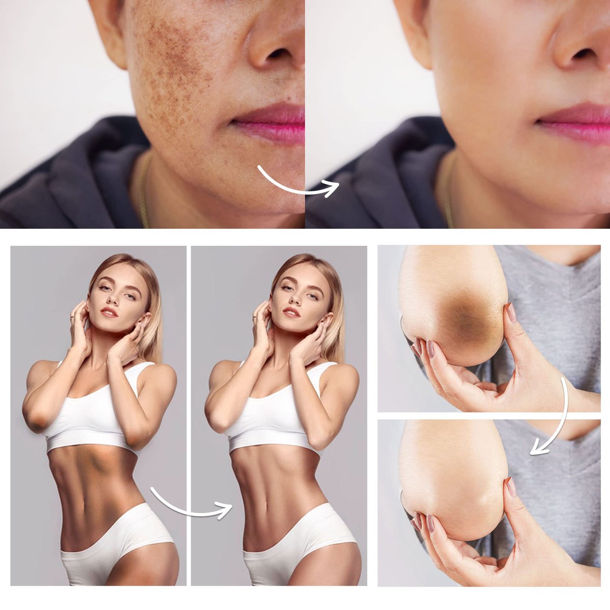 FAMIROSA Intimbereich Dunkle Flecken Korrektur: Creme für Achseln, Knie, Ellbogen, Innenseite der Oberschenkel, Intimbereich - 50 ml