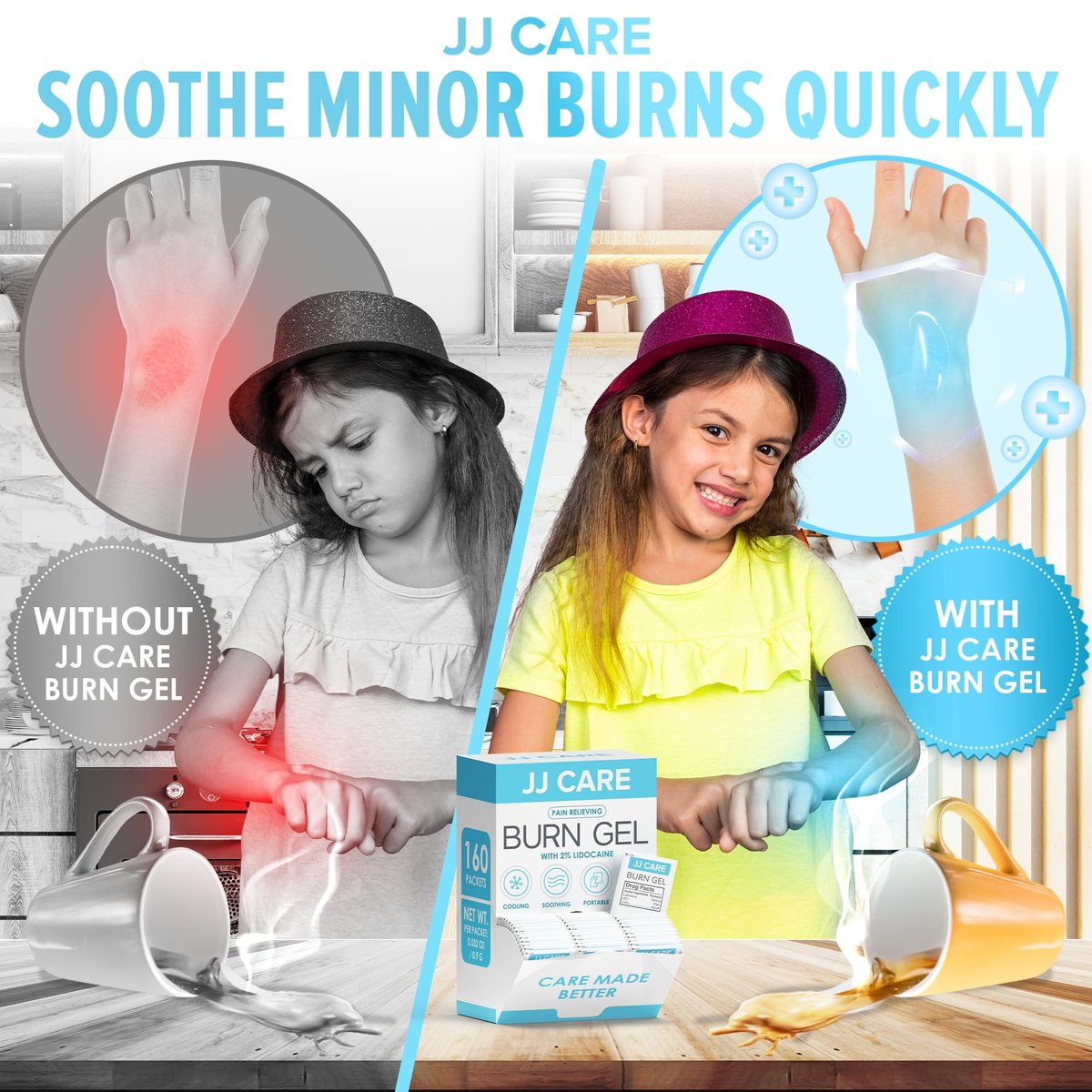 JJ CARE Brandgel (Pack mit 160), Beruhigende Brandgel-Päckchen für leichte Verbrennungen, Erste-Hilfe-Gel & Sonnenbrandlinderung in Einzelpackungen mit Lidocain und Aloe Vera (0,9 g pro Päckchen)