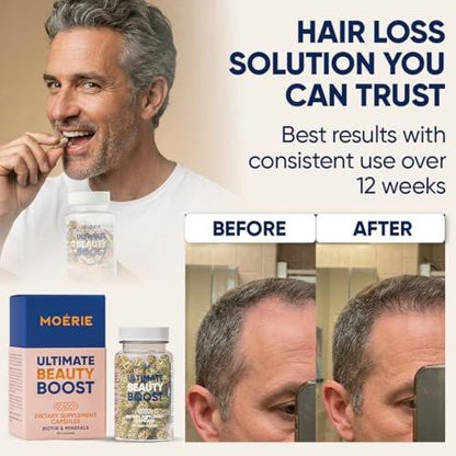 Moerie Ultimate Haarwachstumsergänzung für Frauen & Männer - Haare, Haut, Nägel Vitamine mit Biotin & Mineralien - für dichteres, volleres Haar & Haarausfall Behandlung - 360 Kapseln