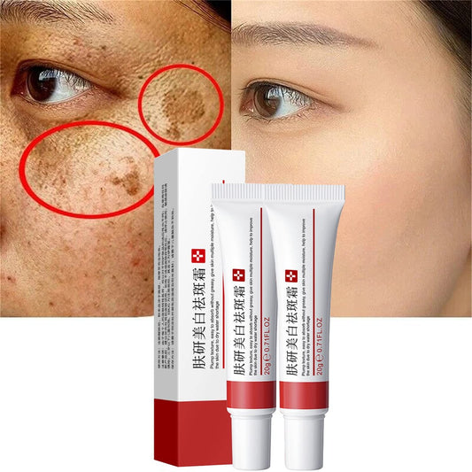 2er-Pack Aufhellende Fleckencreme - Aknenarben Entferner, Pigmentflecken Creme für das Gesicht, Feuchtigkeitsspendend gegen Melasma, dunkle Flecken, Fältchen und Hautunreinheiten