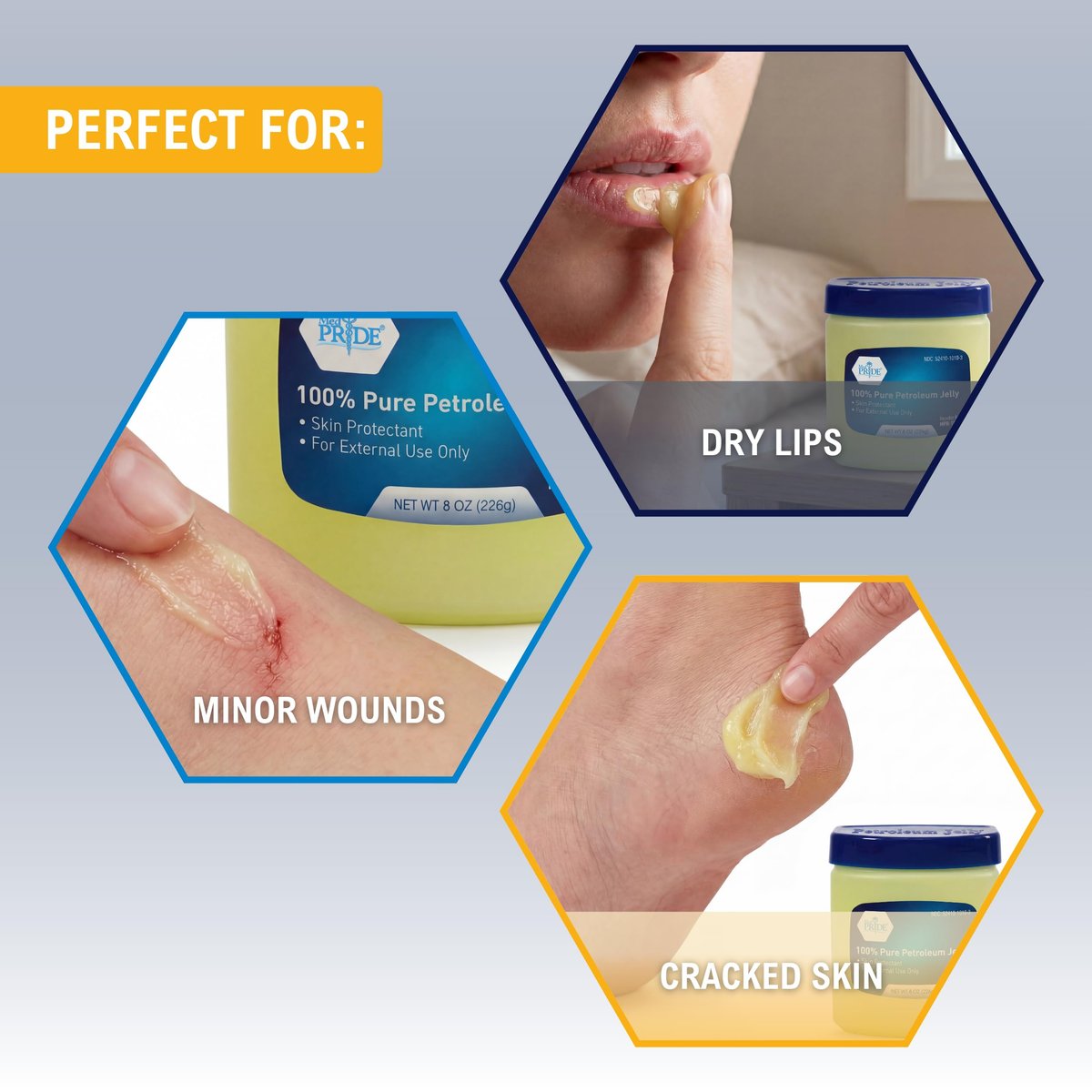 MED PRIDE 100% reines weißes Vaseline – 227 g Hautschutz & Feuchtigkeitscreme für trockene Haut, Ausschlag, Verbrennungen, Wunden, rissige Lippen & Windelausschlag – Duftfrei, hypoallergen, Familienpackung