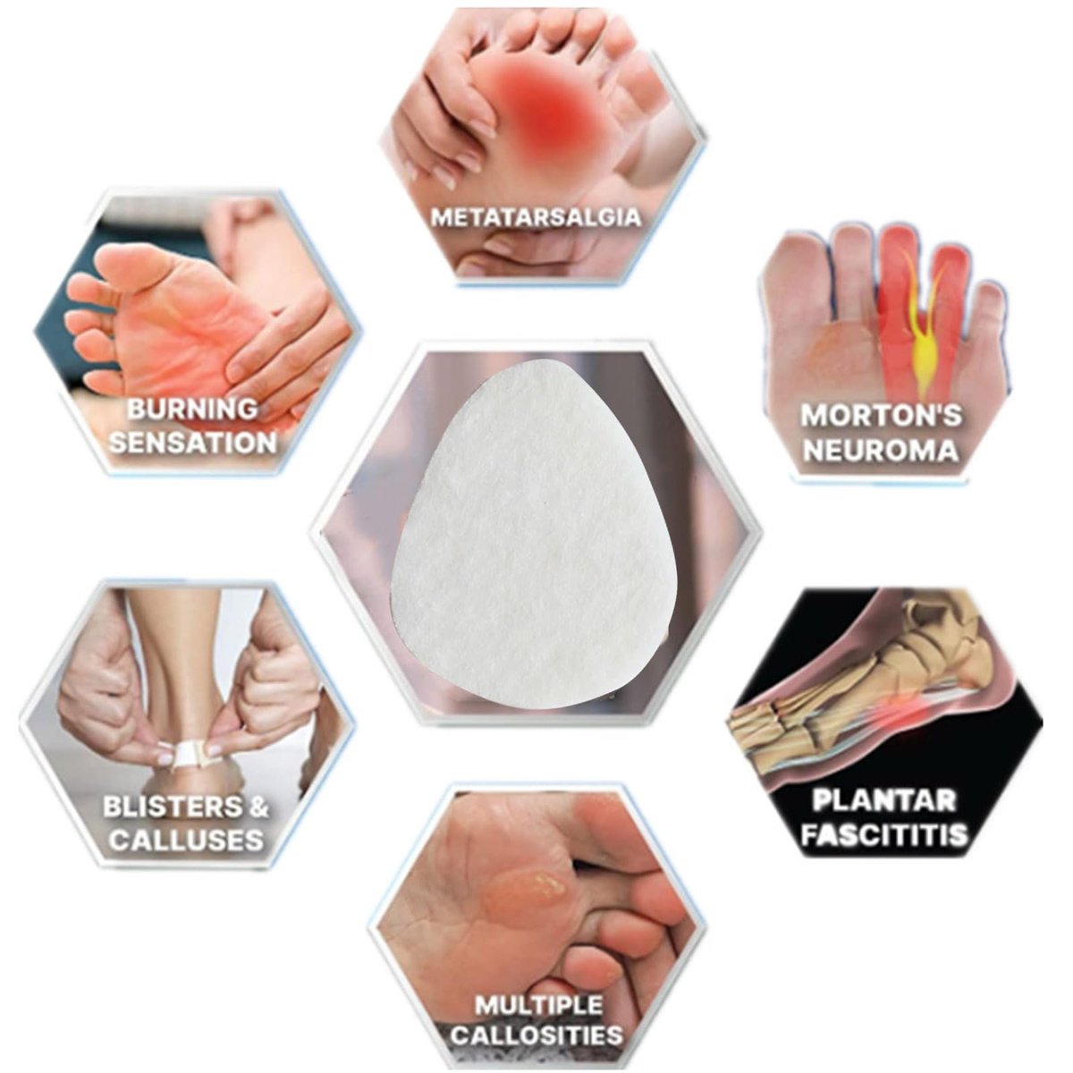 20er-Pack Metatarsal-Pads für Damen und Herren, Filz-Ballenpolster, selbstklebende Fußpolster für Vorfuß und Sohle, Unterstützung bei Metatarsalgie und Morton-Neurom, Weiß