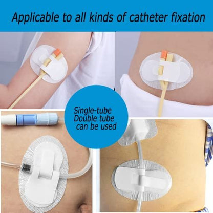 Katheterfixierungsvorrichtung – Beinbeutelhalter mit Klebepad (10er-Pack) – BOJEE