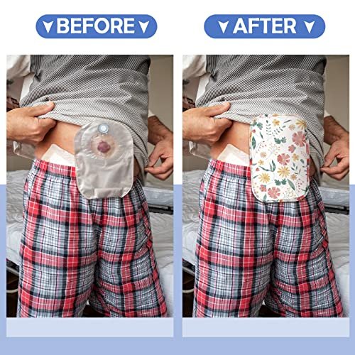 Sosation 6-teilige wasserdichte Stomabeutel-Abdeckungen – Leichte Colostomy-Bag-Überzüge mit Öffnung für Männer und Frauen – Geruchsreduzierendes Ileostomie-Pflegezubehör