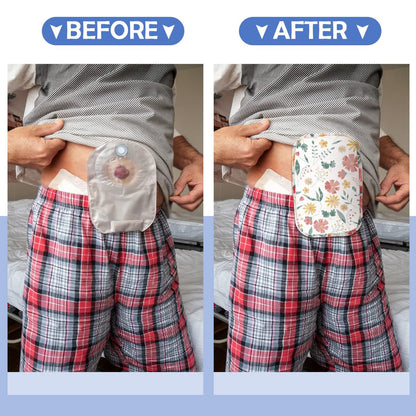 Sosation 6-teilige wasserdichte Stomabeutel-Abdeckungen – Leichte Colostomy-Bag-Überzüge mit Öffnung für Männer und Frauen – Geruchsreduzierendes Ileostomie-Pflegezubehör