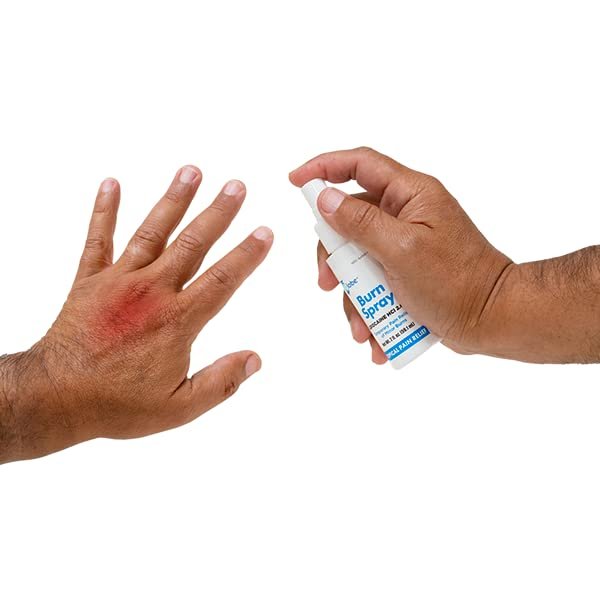 Globe (3er Pack) Brandspray, Lidocain 2% – Topische Anästhetische Schmerzlinderung und Betäubung 2 oz Sprühflasche