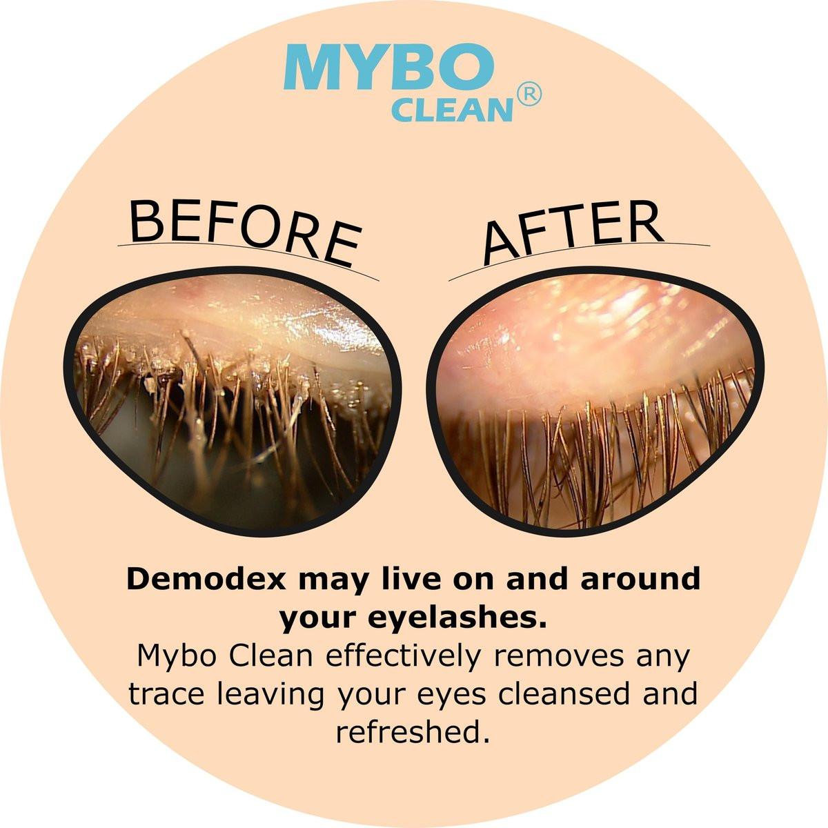 Myboclean Hydrating Lids and Lash Cleansing Gel mit Manuka-Honig UMF 16+, Aloe Vera, Kokosöl, Totes Meer Salz, 1,69 Fl Oz