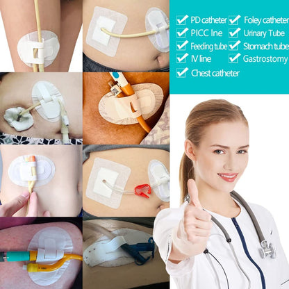 Katheter-Fixierpflaster für Ernährungssonden und PD-Dialyse – 5er Pack – Hola Health