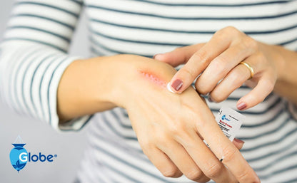Globe First Aid Burn Cream 0,9 g Portionsbeutel (Box mit 144) – Erste-Hilfe-Creme zur Linderung von leichten Verbrennungen, Schnitt- und Schürfwunden