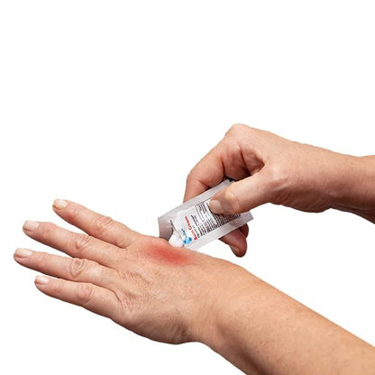 Globe First Aid Burn Cream 0,9 g Portionsbeutel (Box mit 144) – Erste-Hilfe-Creme zur Linderung von leichten Verbrennungen, Schnitt- und Schürfwunden