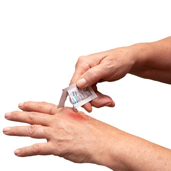 Globe First Aid Burn Gel mit Aloe 0,9g Beutel (Box mit 144 Stück) - Erste Hilfe Gel zur vorübergehenden Linderung von leichten Verbrennungen, Schnitten und Schürfwunden