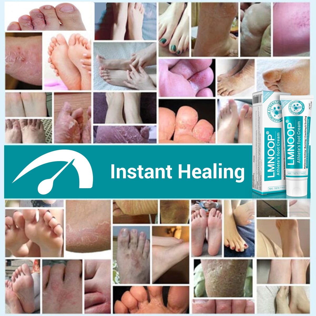 LMNOOP Fußpilz Creme, Maximale Stärke gegen Fußpilz (Tinea Pedis), Juckreiz, Blasen, Brennen, Risse, Schuppen, natürliche Kräuter Antimykotische Fußcreme