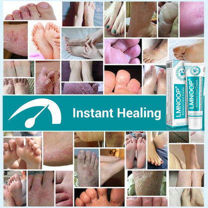 LMNOOP Fußpilz Creme, Maximale Stärke gegen Fußpilz (Tinea Pedis), Juckreiz, Blasen, Brennen, Risse, Schuppen, natürliche Kräuter Antimykotische Fußcreme