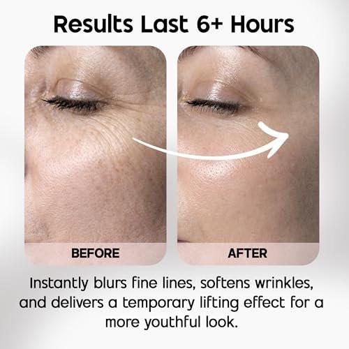 Celestolite Estrella Anti-Falten-Spritze – Hautverjüngung und Faltenreduktion