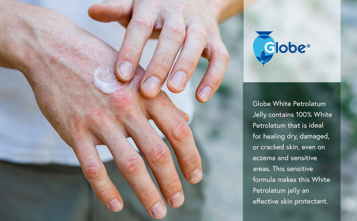 Globe Weißes Petrolatum-Gel – 144 Packungen à 5 g für trockene oder rissige Haut, beruhigend bei leichten Hautreizungen