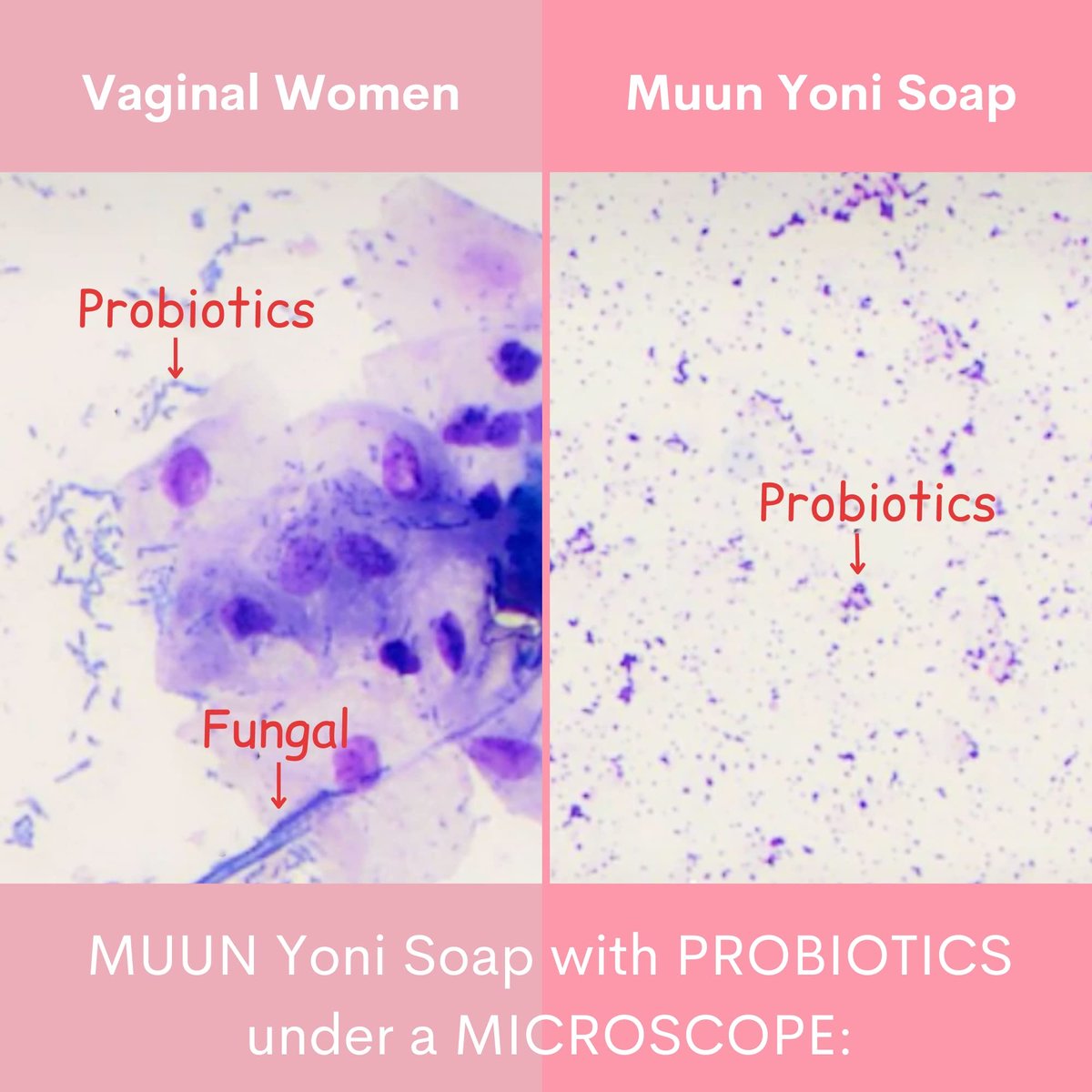 Muun Erdbeer Yoni Seifenbar - 3er Pack pH-ausgleichender Reiniger mit Probiotika & natürlichen Inhaltsstoffen - Sanfte Reinigungsformel beseitigt Gerüche für vaginale Gesundheit - Feuchtigkeitsspendende Intimwäsche