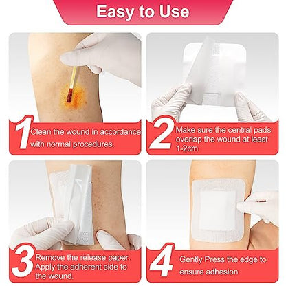 Niceful 50er-Pack Klebeverband mit Gaze 10x10 cm, wasserabweisende Wundauflage, steril & saugfähig, medizinische Klebepads, Erste-Hilfe-Pads FSA-berechtigt