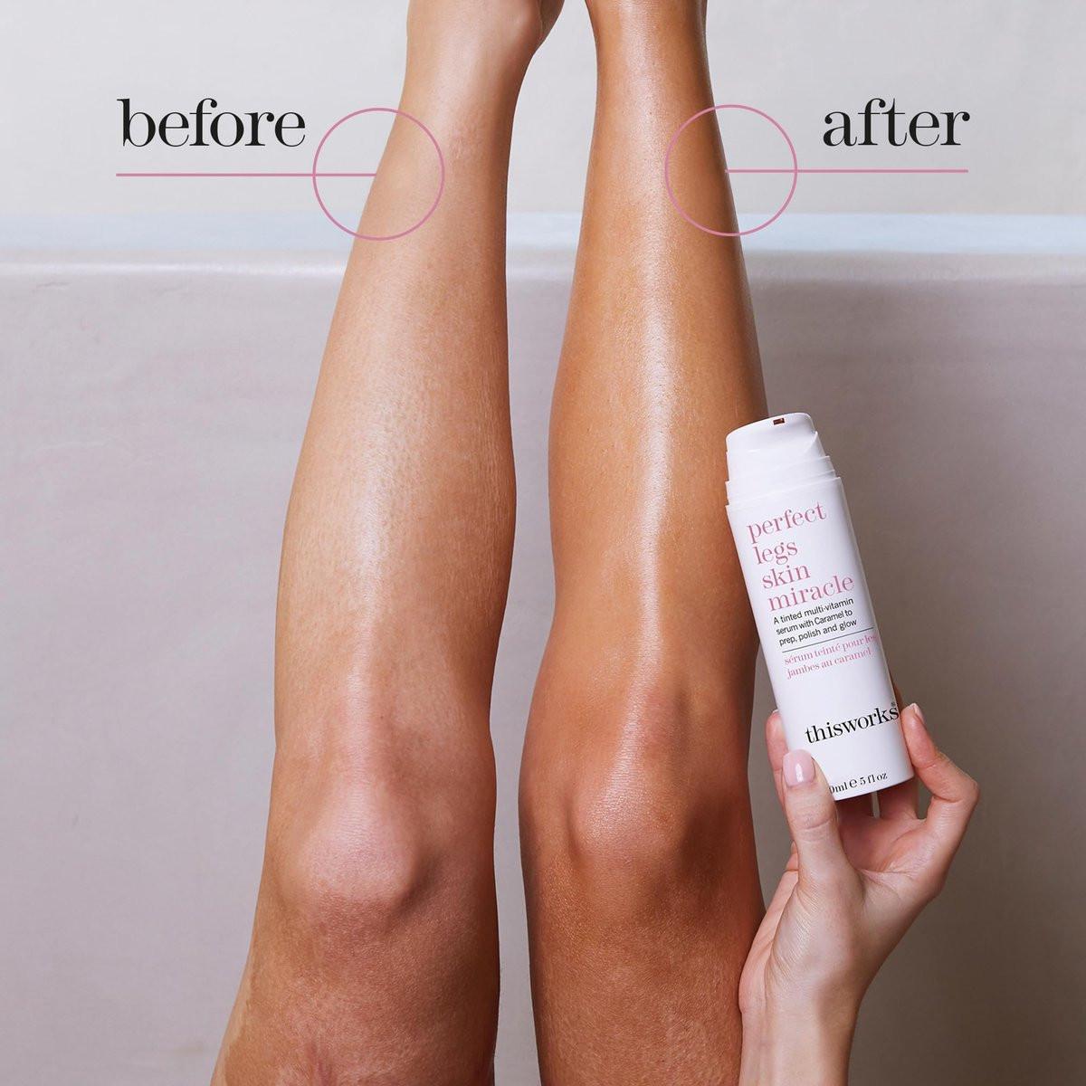 THISWORKS Perfect Legs Skin Miracle: Getönte Hautpflege mit Vitamin C & E für strahlenden, sonnengeküssten Glow – Gleicht Hautton aus & reduziert Unreinheiten, 150 ml