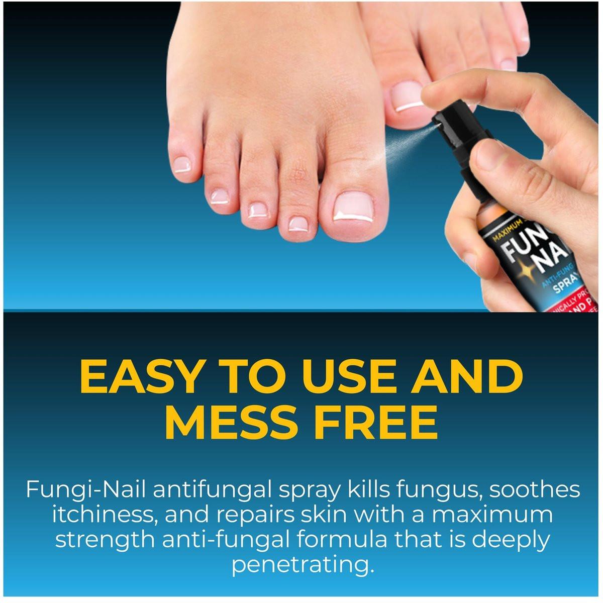 Fungi-Nail Anti-Fungal Fußspray – Tötet Pilze, die zu Nagel- und Fußpilz führen können, mit Tolnaftat & klinisch erwiesen – 30 ml