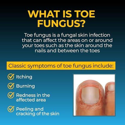 Fungi-Nail Anti-Fungal Fußspray – Tötet Pilze, die zu Nagel- und Fußpilz führen können, mit Tolnaftat & klinisch erwiesen – 30 ml