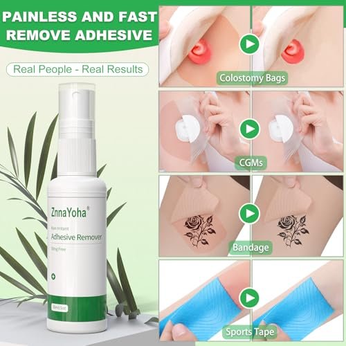 ZnnaYoha Klebstoffentferner Spray – Sanfter medizinischer Klebstoffentferner für Haut, ideal für Stomapatienten, empfindliche Haut und Pflasterentfernung, alkoholfrei, 30 ml