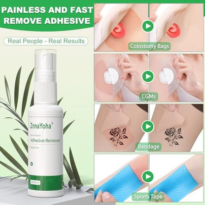 ZnnaYoha Klebstoffentferner Spray – Sanfter medizinischer Klebstoffentferner für Haut, ideal für Stomapatienten, empfindliche Haut und Pflasterentfernung, alkoholfrei, 30 ml