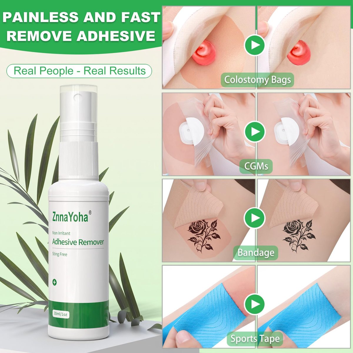 ZnnaYoha Klebstoffentferner Spray – Sanfter medizinischer Klebstoffentferner für Haut, ideal für Stomapatienten, empfindliche Haut und Pflasterentfernung, alkoholfrei, 30 ml