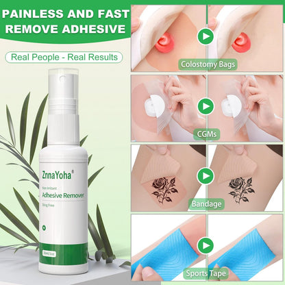 ZnnaYoha Klebstoffentferner Spray – Sanfter medizinischer Klebstoffentferner für Haut, ideal für Stomapatienten, empfindliche Haut und Pflasterentfernung, alkoholfrei, 30 ml