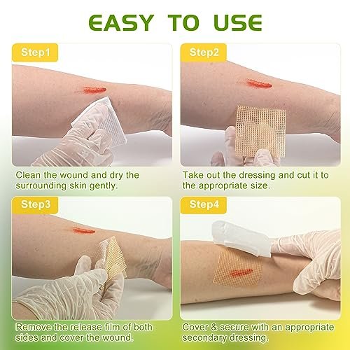 OPTITEKNIK Manuka Honig Wundauflage 5x5 cm, 10er Pack – Manuka Honig Wundversorgung für Schnitte, Verbrennungen und Schürfwunden