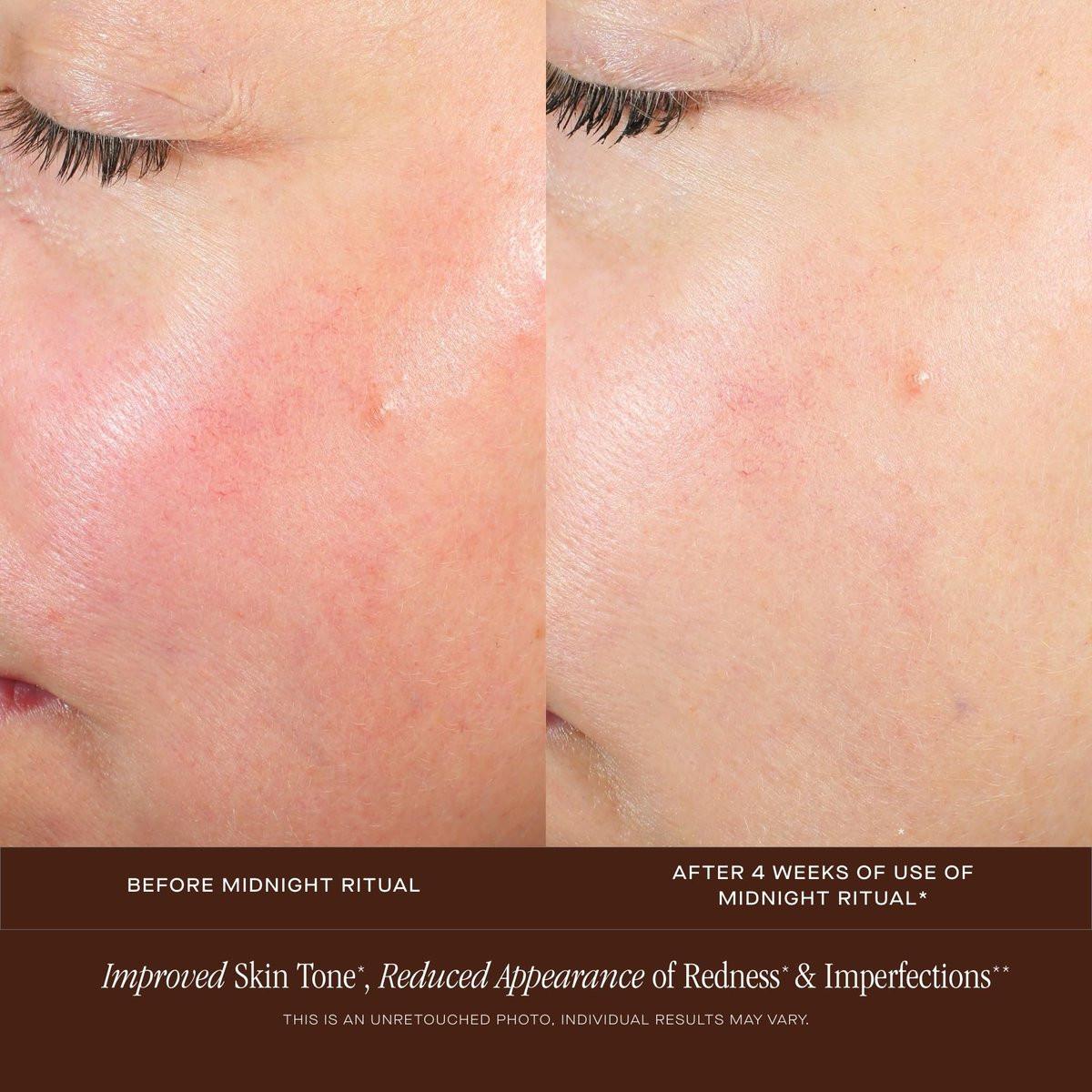 Summer Fridays Midnight Ritual Retinol Serum – Anti-Aging Gesichtsserum mit Retinol, Jojobaöl, Hyaluronsäure & Niacinamid gegen feine Linien & Verfärbungen (30 ml)