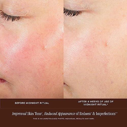 Summer Fridays Midnight Ritual Retinol Serum – Anti-Aging Gesichtsserum mit Retinol, Jojobaöl, Hyaluronsäure & Niacinamid gegen feine Linien & Verfärbungen (30 ml)