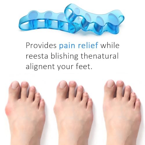 Sosede 4er-Pack Zehenspreizer, Ballenzeh-Korrektor für Frauen und Männer, Zehenabstandshalter zur Korrektur von Ballenzehen, Yoga-Zehen-Strecker, Big Toe Corrector, Gel-Trenner (Blau+Pink)