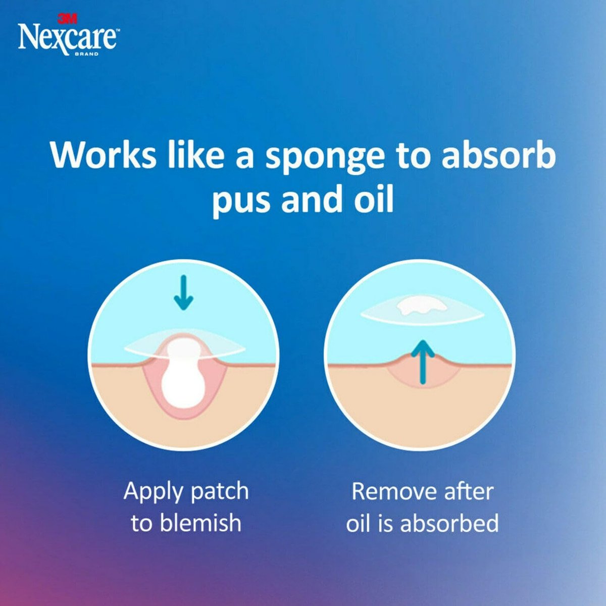Nexcare Dünne und Transparente Akne-Pflaster, Hydrokolloid-Pflaster zur Absorption von Eiter und Öl aus verstopften Poren, mit Lasche zur einfachen Entfernung – 39 Pickel-Patches