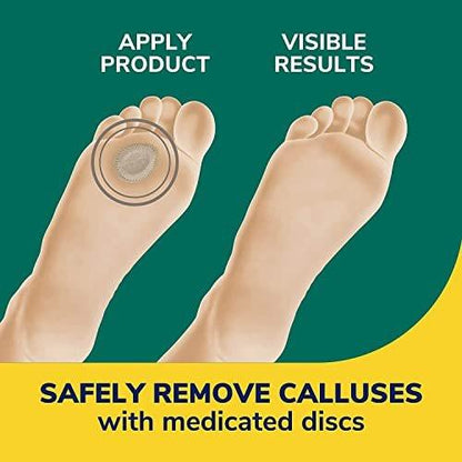 Dr. Scholl's Extra Dicker Hornhautentferner, 4 Stück // Hilft, harte Hornhaut zu erweichen und polstert für ganztägige Schmerzlinderung (2er-Pack)