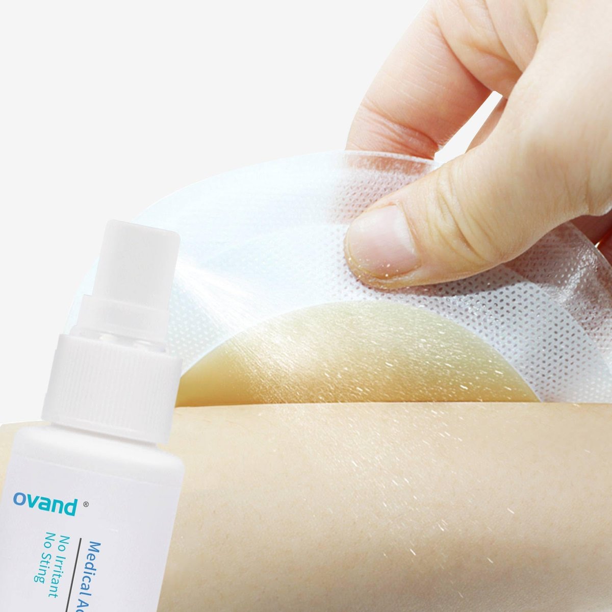 Medizinischer Klebstoffentferner Spray - 30 ml. Sanfter Ostomie-Klebstoffentferner: Kleberentferner für Haut, Stoma, Brustprothese, Klebeband