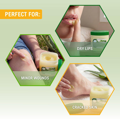 MED PRIDE Petroleum Jelly mit Aloe Vera & Vitamin E, 227 g – Hautschutz und Feuchtigkeitscreme für trockene oder gereizte Haut, Ausschläge, rissige Lippen, kleine Schnitte, Verbrennungen und Windeldermatitis
