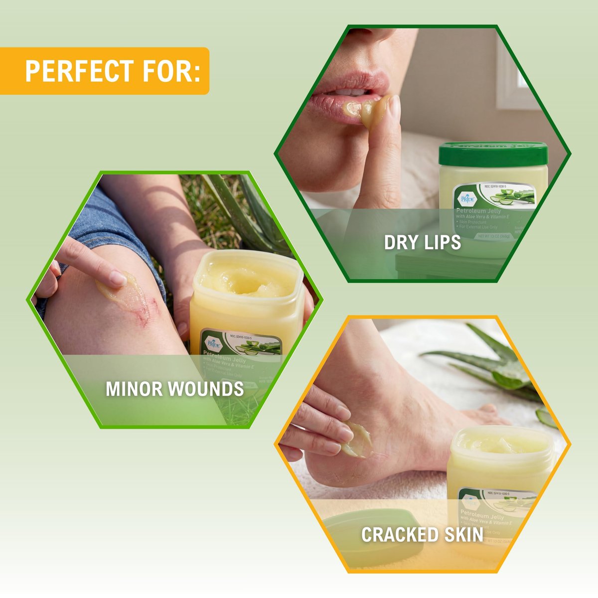 MED PRIDE Petroleum Jelly mit Aloe Vera & Vitamin E, 13 oz – Hautschutz und Feuchtigkeitscreme für trockene oder gereizte Haut, Ausschlag, rissige Lippen, kleine Schnitte, Verbrennungen und Windelausschlag