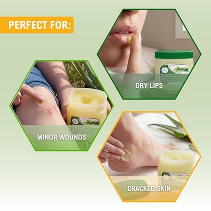 MED PRIDE Petroleum Jelly mit Aloe Vera & Vitamin E, 13 oz – Hautschutz und Feuchtigkeitscreme für trockene oder gereizte Haut, Ausschlag, rissige Lippen, kleine Schnitte, Verbrennungen und Windelausschlag