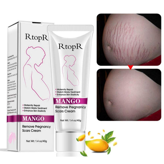 Mango Stretch Marks and Scar Cream – Dehnungsstreifen & Narbencreme für Schwangerschaft, Falten, Fettpölsterchen, Feuchtigkeitscreme (40g)