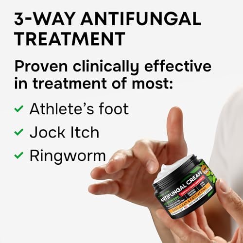 SimplyVital 1% Clotrimazol Antimykotische Creme - Behandelt Fußpilz, Juckreiz, Ringelflechte - Anti-Pilz-Creme für die Haut, 2 Unzen