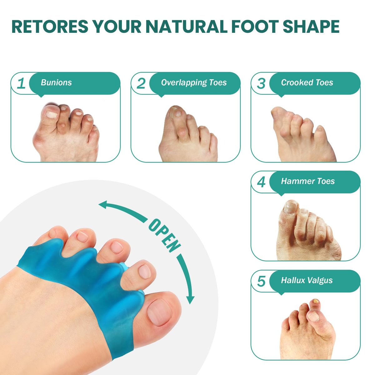 Welnove Silikon-Zehenspreizer für Hallux Valgus Korrektur – 8er-Pack Zehenspacer für Männer und Frauen, Hammerzehen-Richtgerät, Yoga-Übungen, Fußausrichtung, FSA- oder HSA-berechtigt